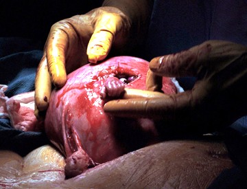 Picure of doctor holding Baby Samuel's hand