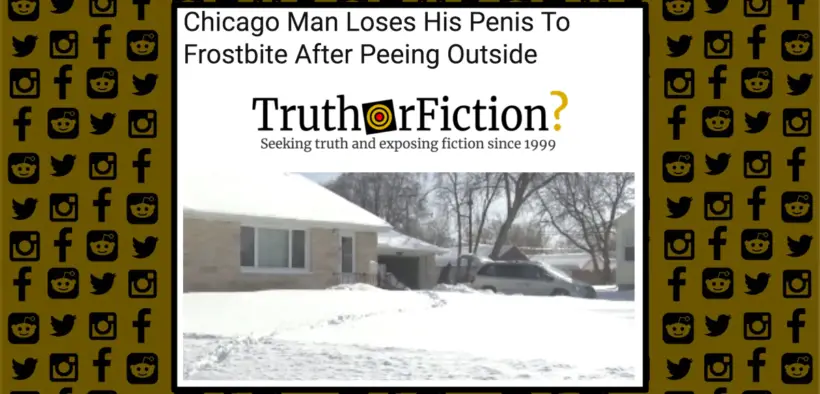 chicago_man_loses_penis_frostbite