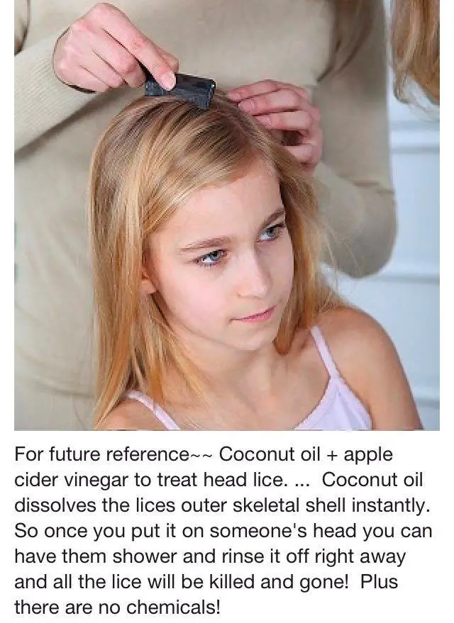lice-acv-coconut-oil