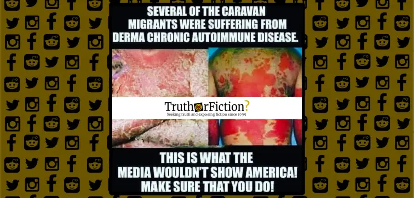 derma_chronic_autoimmune_disease
