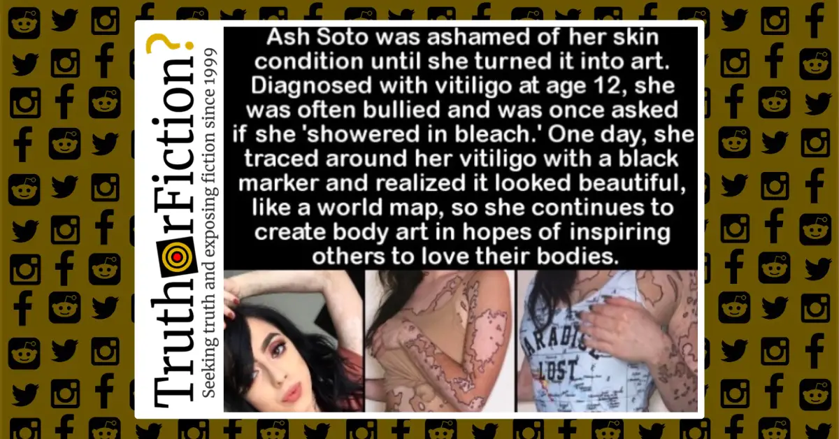 Ash Soto and her Vitiligo Body Art