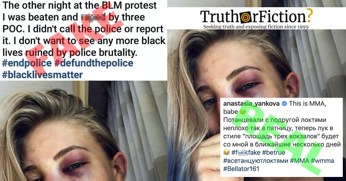 This Photograph Does Not Show a Woman Who Was Beaten and Sexually Assaulted at a BLM Protest