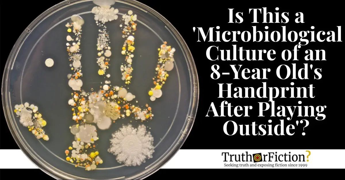 ‘Microbiological Culture of an Eight Year Old’s Handprint After Playing Outside’